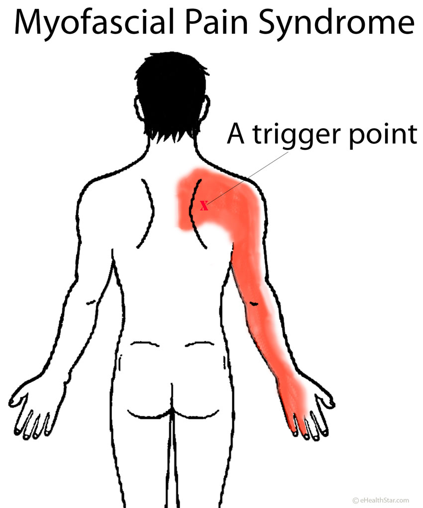 Pain In Right Shoulder Blade And Right Breast At Lonnie Beebe Blog