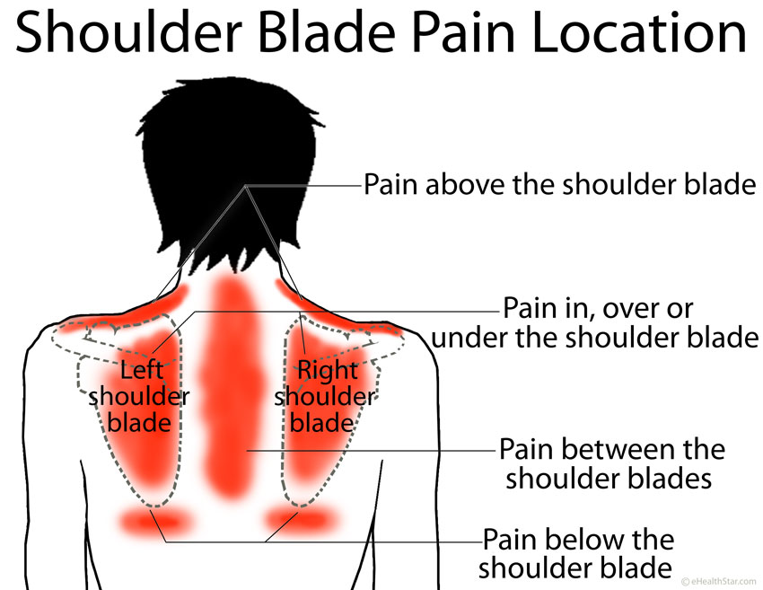 Shoulder Shoulder Blade Scapula Pain