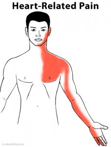 Arm Pain: Left, Right, Both, Sharp, Dull, Muscle, Nerve, in Women ...