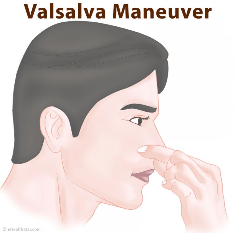 valsalva-maneuver-definition-purpose-uses-effects-dangers-ehealthstar